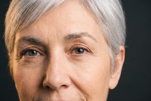 Sample photo for Droopy eyelid surgery (model image)