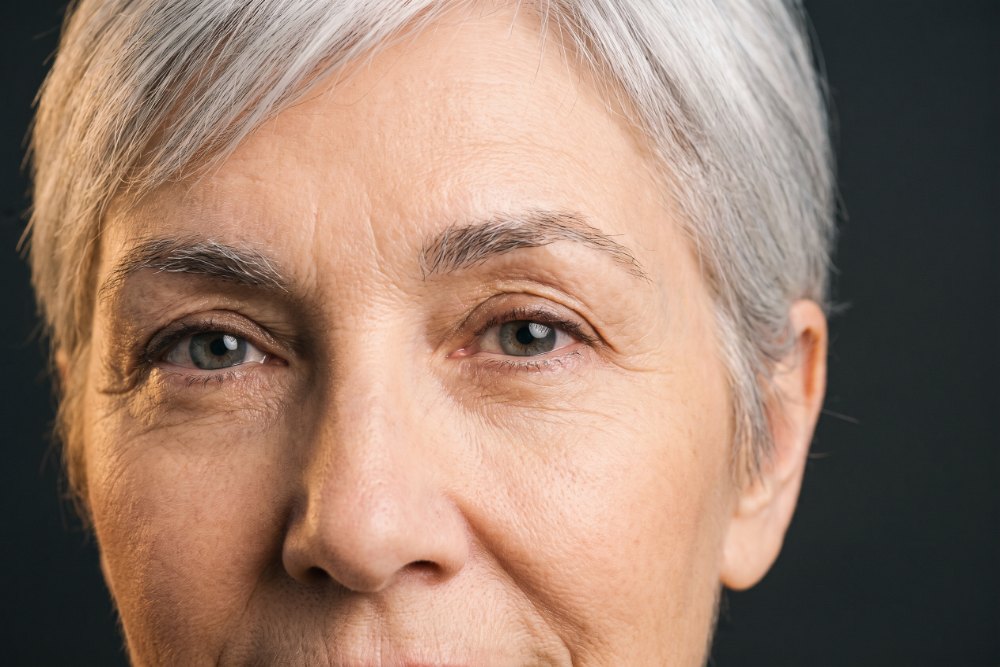 Sample photo for Droopy eyelid surgery (model image)