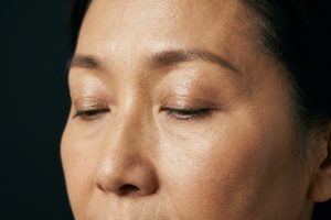 Sample photo for Eye socket lump biopsy and removal (model image)