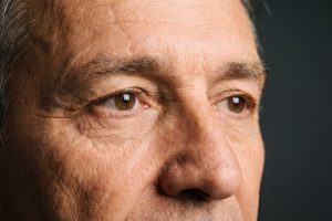 Sample photo for Eyelid lump removal and reconstruction (model image)