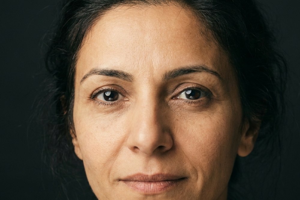 Sample photo for Eyelid retraction (model image)
