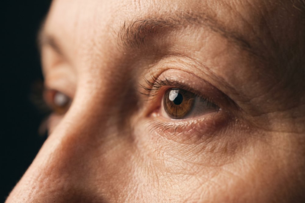 Sample photo for Inturned eyelid repair (model image)