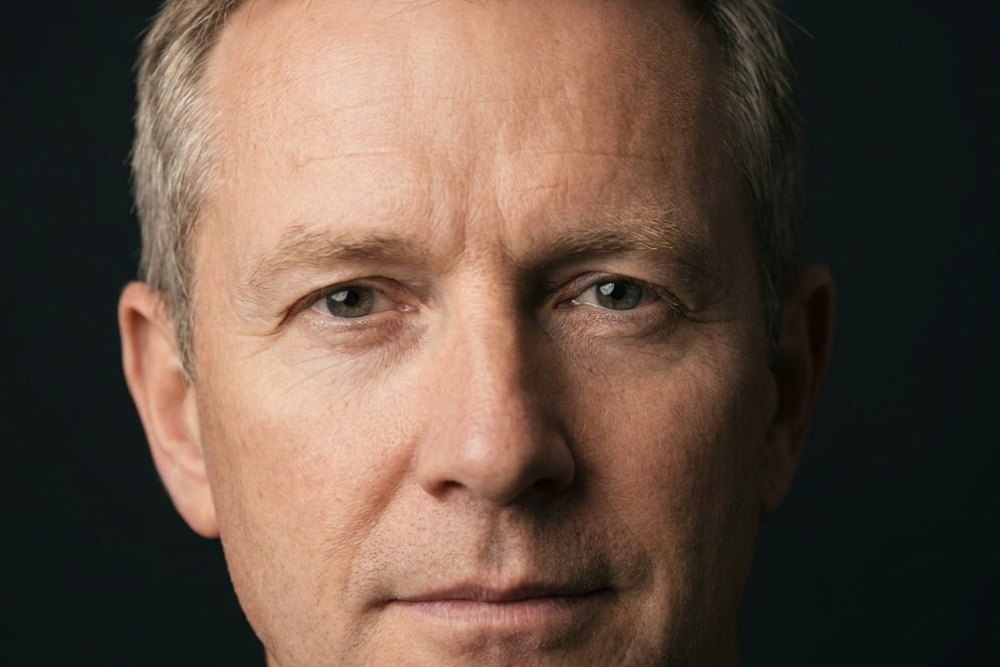 Sample photo for Under-eye bags (model image)